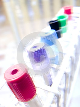 Laboratory test tubes abstract