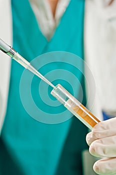 Gloved hand holding test tube with urine label