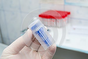 Laboratory worker holding in his hand a bottle for feces samples