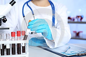 Laboratory worker taking test tube with blood sample