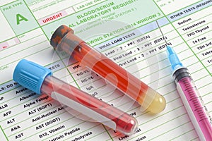 Labs Blood Work