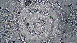 Lactic acid bacilli in leaven from milk under a microscope