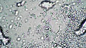 Lactobacilli in breast yeast under magnification of the microscope