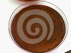 Lactobacillus.spp on MRS medium