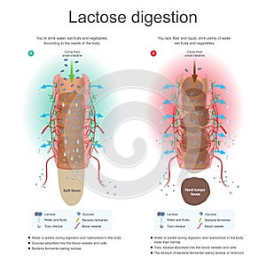 Lactose digestion. Water is added during digestion and reabsorb in the body. Bacteria fermenter eating lactose. Toxic residue abso