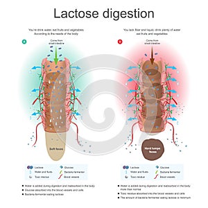 Lactose digestion. Water is added during digestion and reabsorb in the body. Bacteria fermenter eating lactose. Toxic residue abso photo