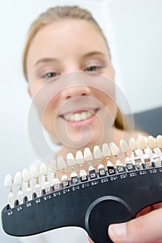 Lady showing teeth to match with color samples