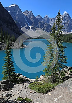 Lake Moraine Vista