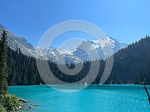 Landscape of Lower Joffre Lake surrounded by snowy mountains and greenery in Canada