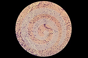 Langerhans cells LC in microscopic slide