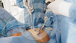 Laparoscopic surgery in hospital. Modern medical equipment in operating room. Surgical intervention in abdominal cavity