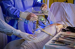 Laparoscopic surgery operation