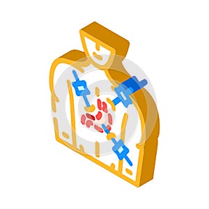 laparoscopy surgery isometric icon vector illustration