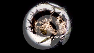 A large colony of scavenger microorganisms eats a dead decomposing mite time lapse