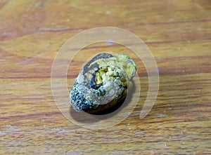 Large gallstone, Gall bladder stone. The result of gallstones