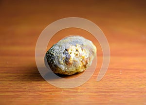 Large gallstone, Gall bladder stone. The result of gallstones