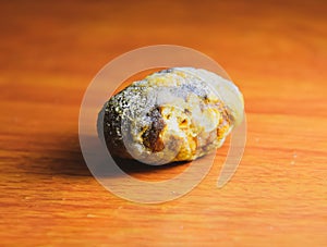 Large gallstone, Gall bladder stone. The result of gallstones