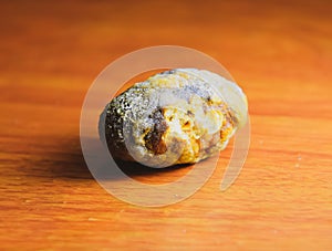Large gallstone, Gall bladder stone. The result of gallstones photo