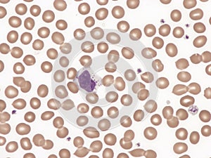 Large granular lymphocyte.