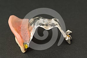 Large image of a modern arc denture with attachmens
