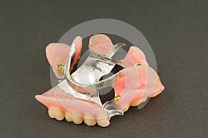 Large image of a modern arc denture with attachmens