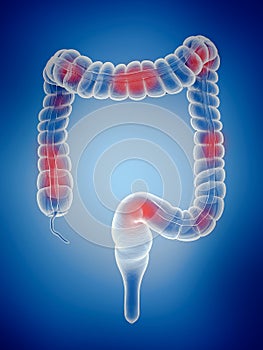 The large intestine