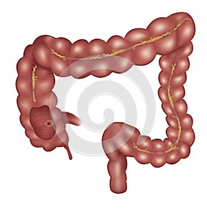 Large intestine anatomy