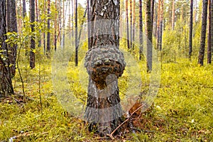 Large outgrowth on a tree trunk. Birch suvel. Tree diseases