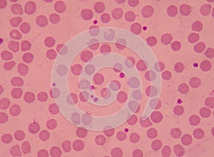 Large platelets on blood smear. photo