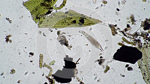 A large rotifer moves among a variety of microorganisms