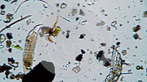 A large rotifer worm feeds between algae and mud in a drop of water under a microscope