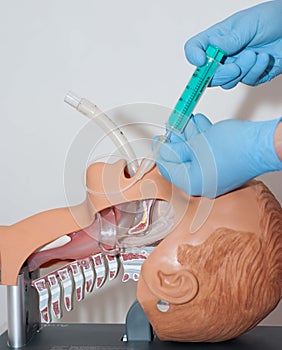 Laryngeal mask used to open the airway