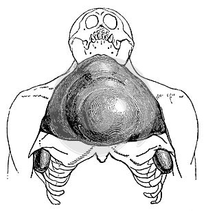 Larynx pouches of the orangutang.