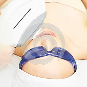 Laser facial hair removal. Cosmetology ipl device. Woman body in clinic. Medical beauty girl. Acne salon treatment tool