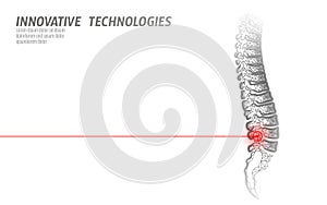 Laser physiotherapy human spine injury. Pain area surgery operation modern loin medicine technology low poly triangles