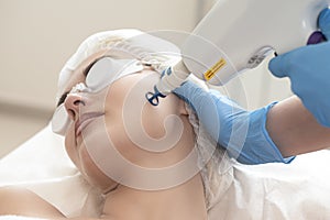 Laser Procedures Ideas. Caucasian Woman Getting Cosmetology Laser Facial Beauty Treatment While Removing Pigmentation in Clinic
