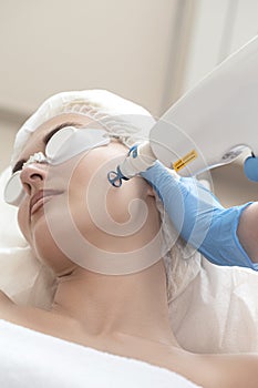 Laser Procedures Ideas. Caucasian Woman Getting Cosmetology Laser Facial Beauty Treatment While Removing Pigmentation in Clinic