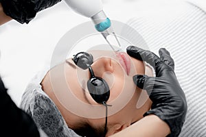 Laser removal of permanent make-up on face lips of young woman in salon