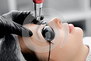 Laser removal of permanent makeup eyebrow of young woman in salon photo