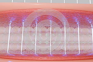 Laser shot through skin layer to collagen for Saggy skin and Facial treatment.