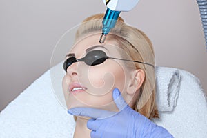 Laser tattoo removal on woman`s eyebrows in a beauty salon