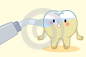 Laser teeth with whitening concept