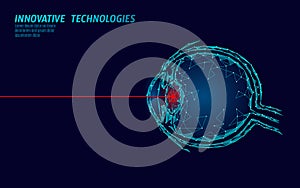 Laser vision correction medicine operation concept. Innovation technology health care. Eye 3D low poly polygonal