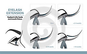 Lash Extension Life Cycle. How Long Do Eyelash Extensions Stay On. Side View. Infographic Vector