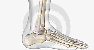 Lateral Ankle Sprain Torn Anterior Talofibular Ligament