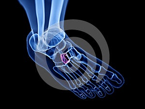 The lateral cuneiform bone