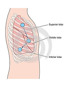 Lateral lung auscultation sites