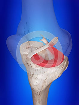 The lateral meniscus photo