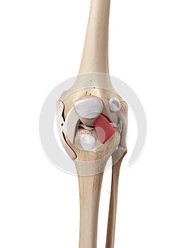 The lateral patellar ligament
