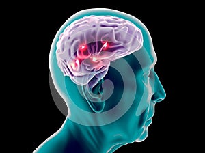 Lateral view of a brain of an elderly man. Neurons and synapses. Parkinson, Alzheimer.